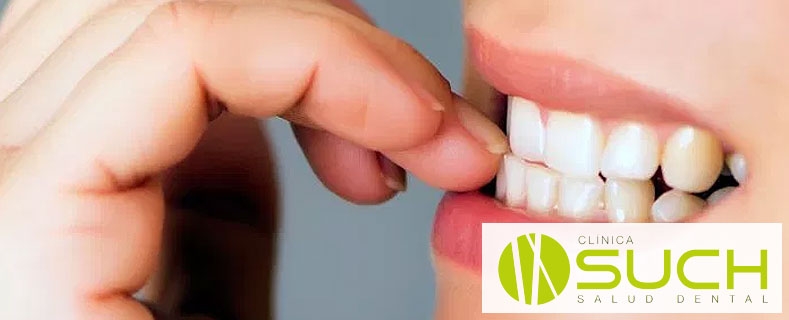 Malas conductas y hábitos que dañan los dientes