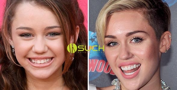 Miley Cyrus dientes